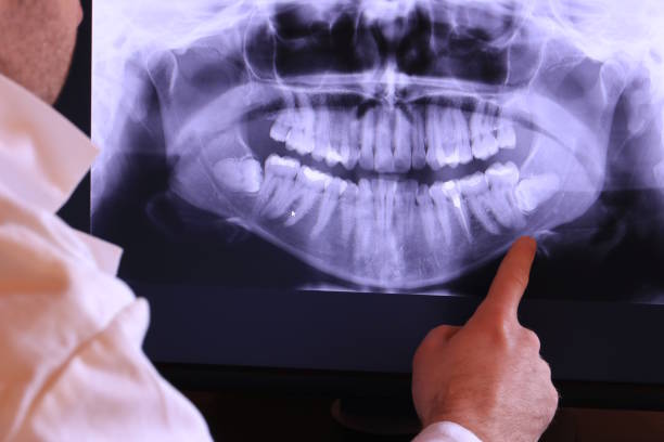 Best Emergency Dental Services for Seniors in Marist College, NY