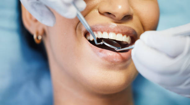 Best Broken or Cracked Tooth Emergency Dentist in Marist College, NY